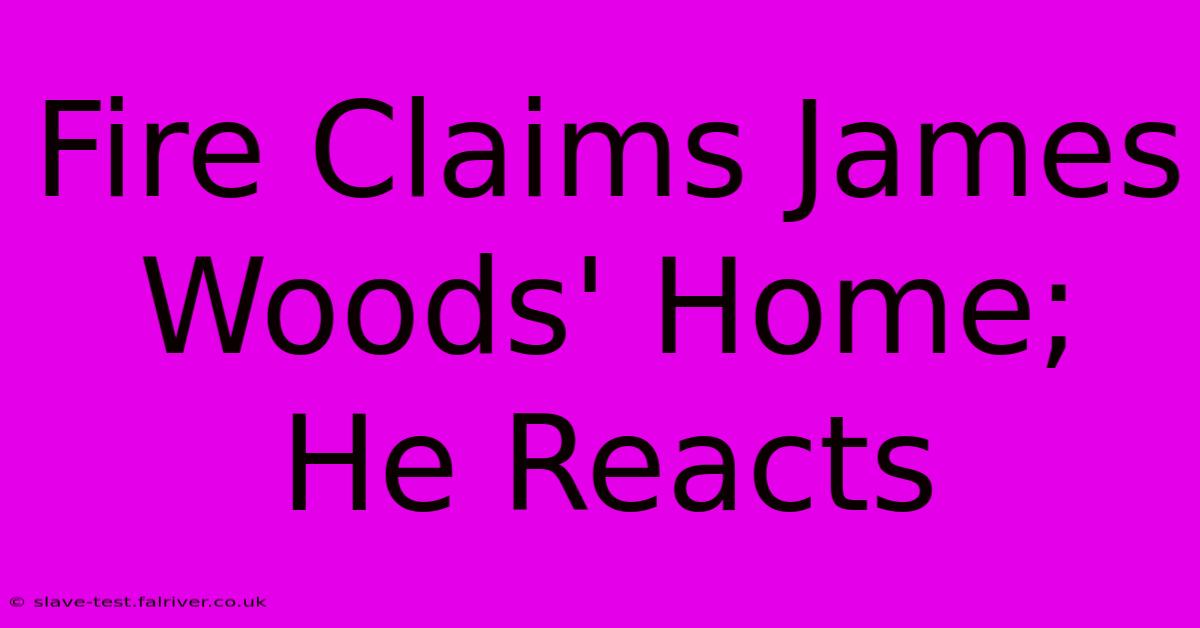 Fire Claims James Woods' Home; He Reacts